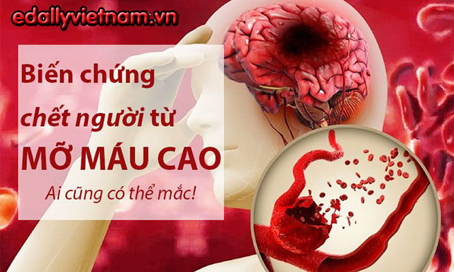 Bien Chung Mo Mau Cao